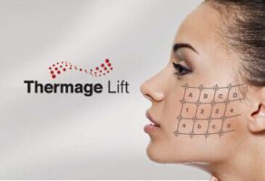 Thermage Lift